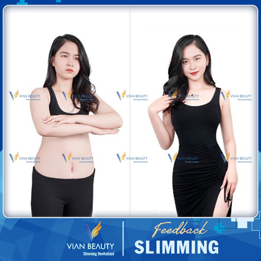 feedback slimming 1