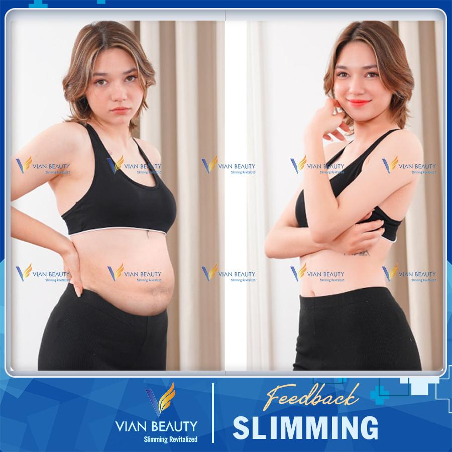 feedback slimming 2