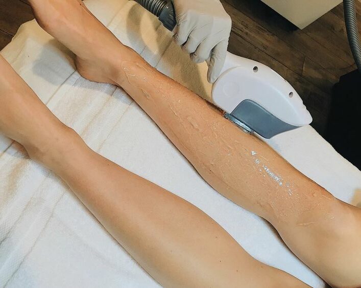 Need advanced, modern hair removal technology